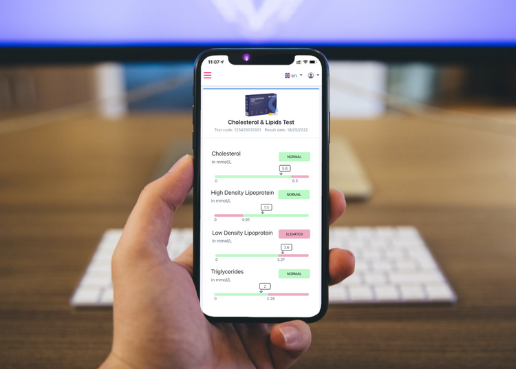 Cholesterol Test - Uitgebreid